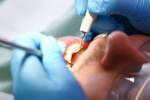 Best Emergency Denture Repair in Macon, MS